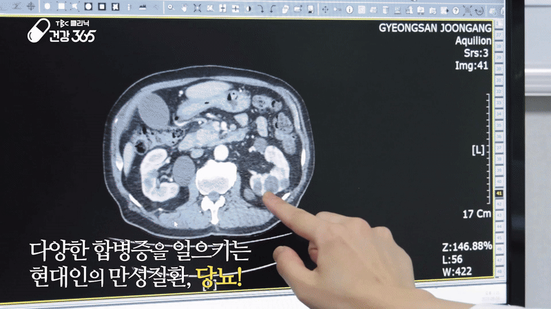 e81f74a8e2c5285a272f5a3f15fd463b_1735541450_9082.gif
